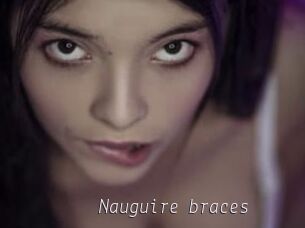 Nauguire_braces